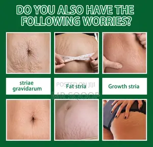 Jaysuing 7 Days Stretch Marks Removal Spray Postpartum