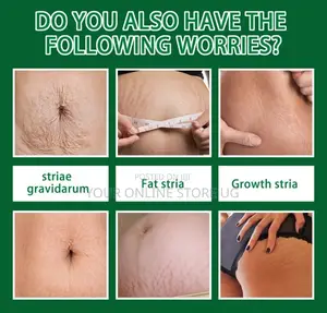 2pcs Jaysuing Stretch Mark Care Spray for Skin Care Routine