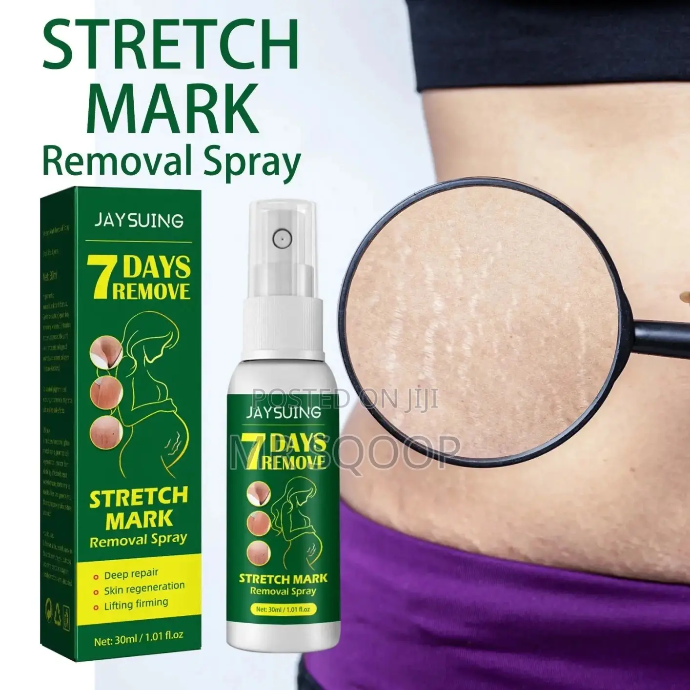 Jaysuing 7 Days Stretch Marks Removal Spray Postpartum