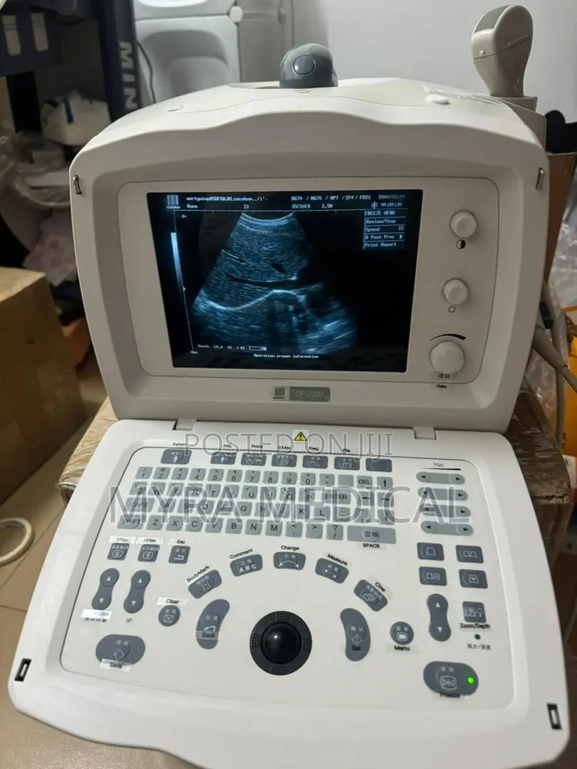Mindray Dp 2200