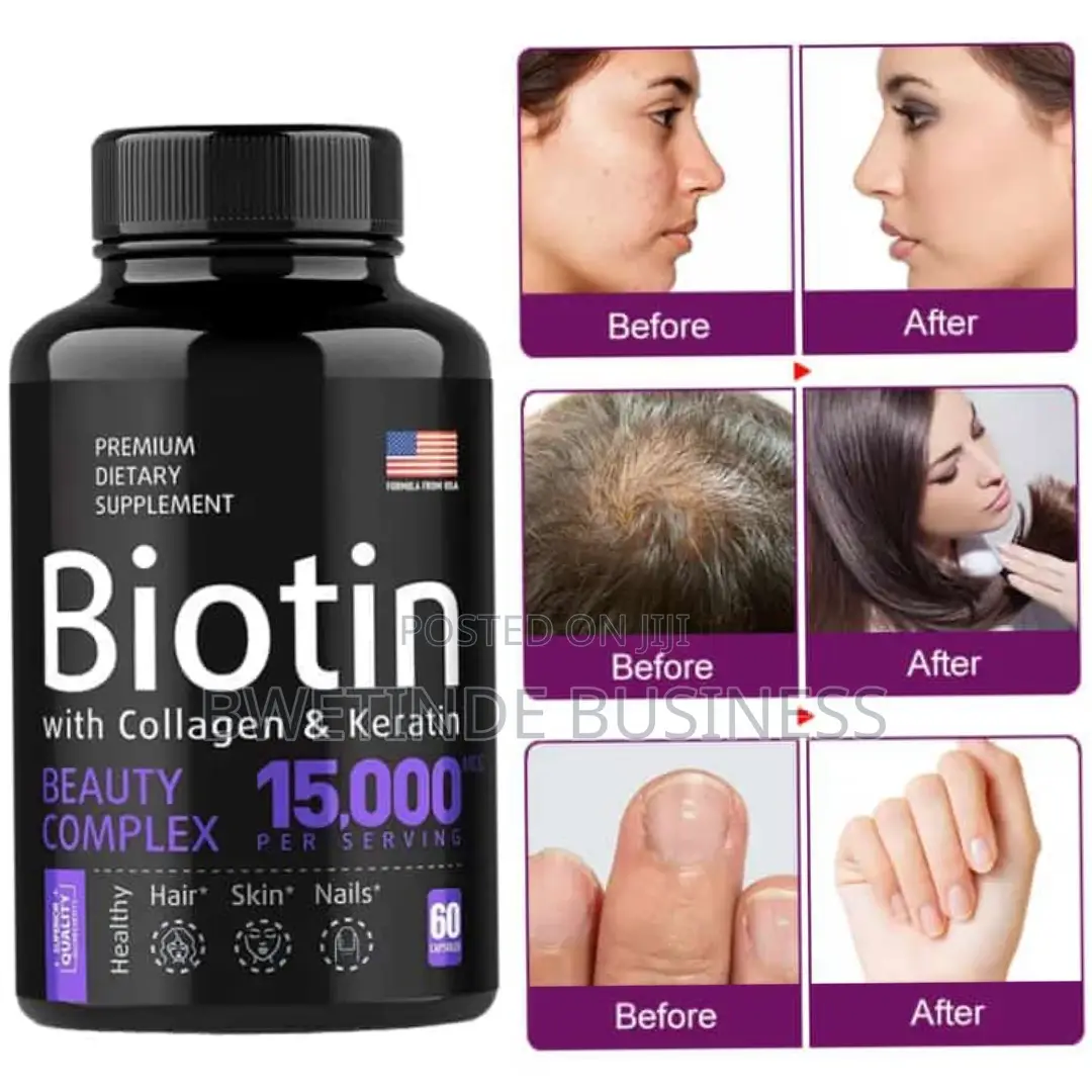 Hair Growth Supplement for Women Men