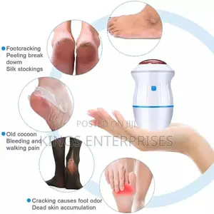 Rechargeable Portable Callus Remover