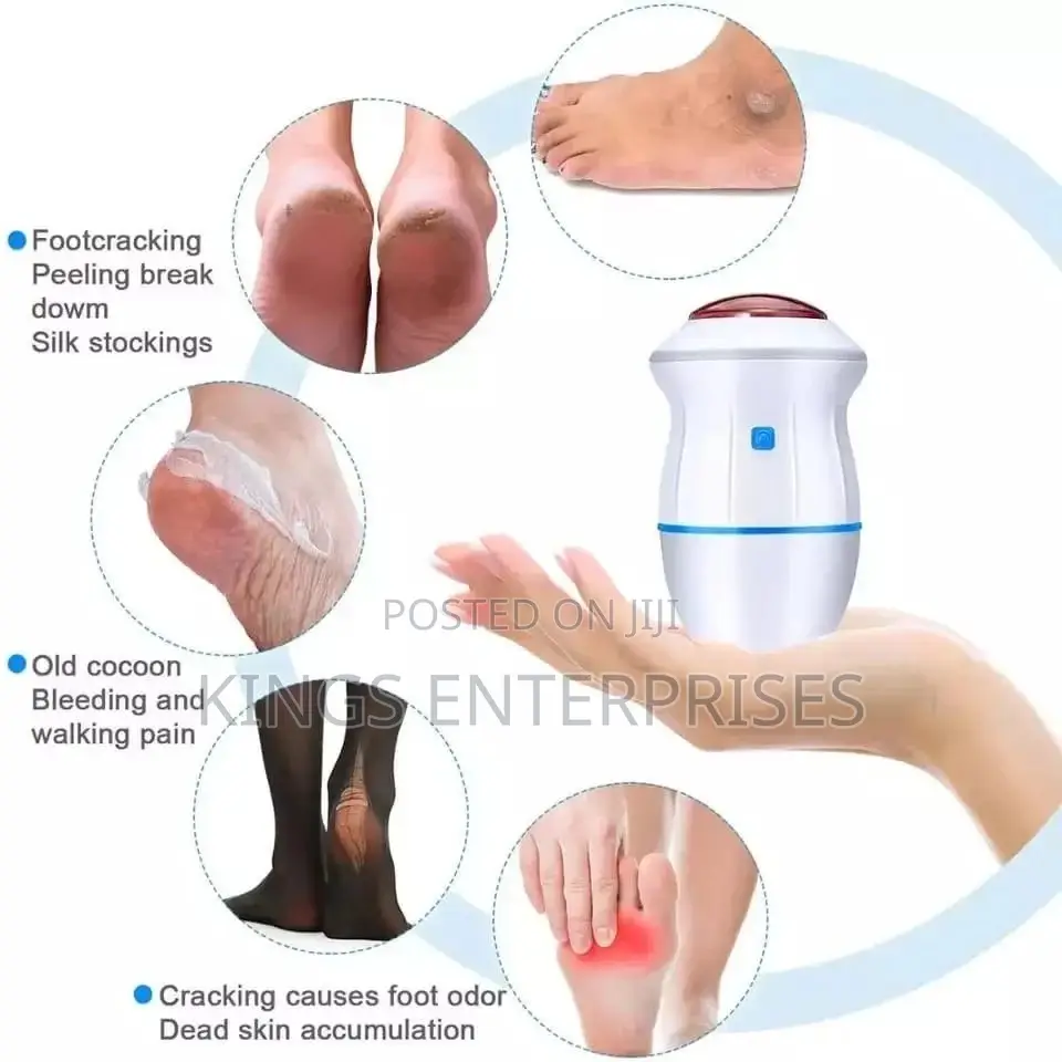 Rechargeable Portable Callus Remover