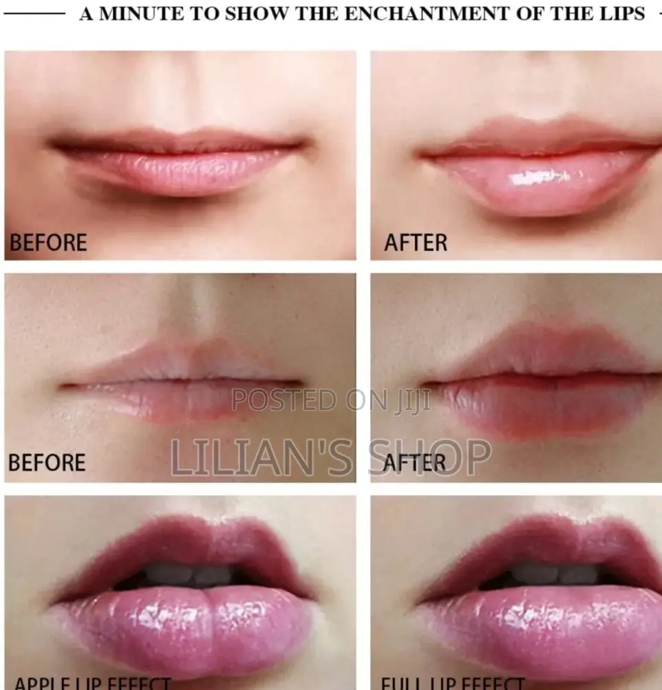 Rechargeable Electric Lip Plumper