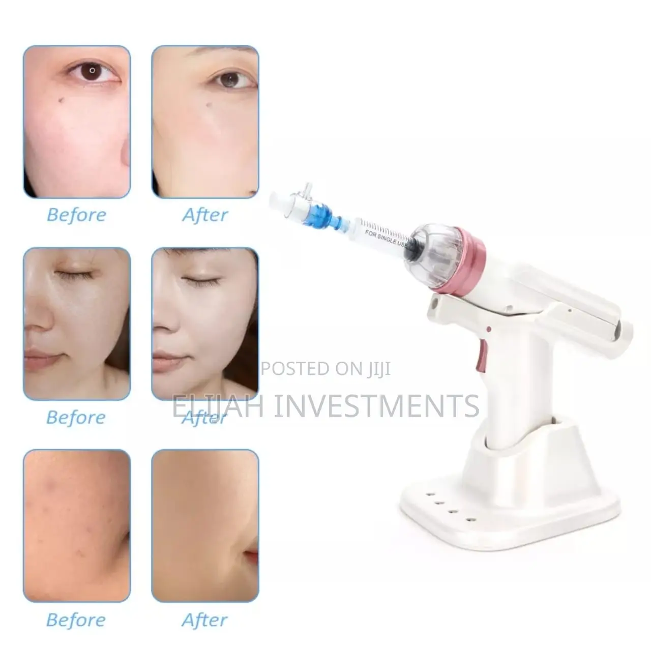 Portable Mesotherapy Gun for Face Skin Wrinkle Removal