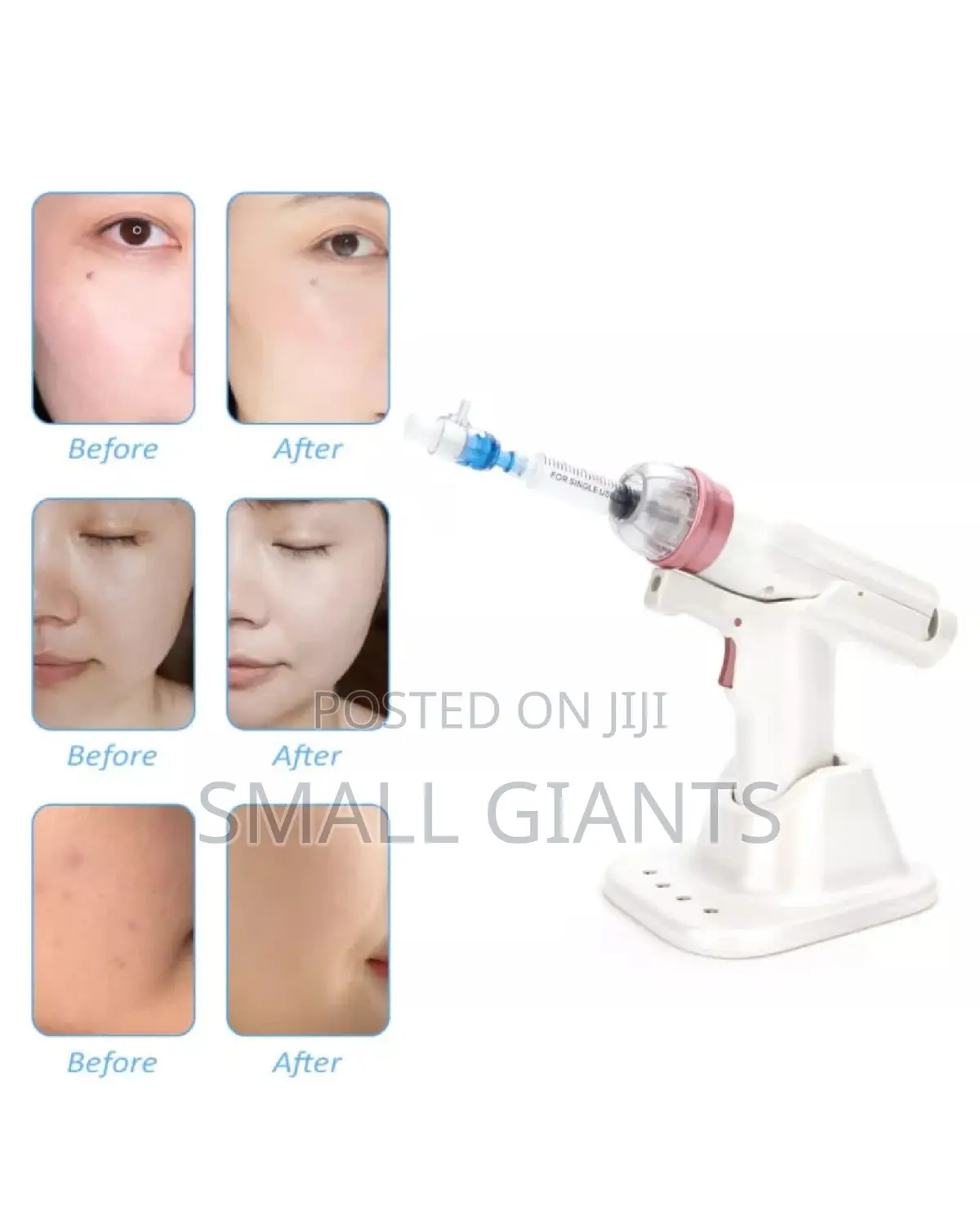 Portable Mesotherapy Gun For Face Lifting Wrinkle Removal