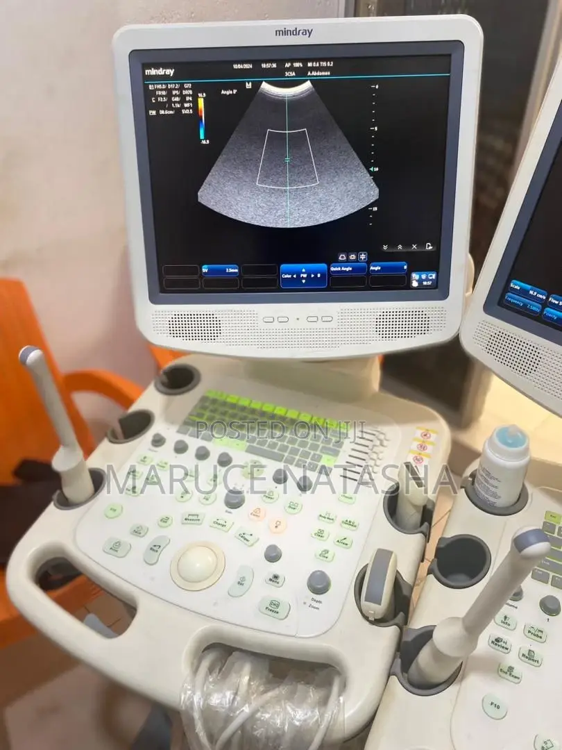 High End 4D Ultrasound Scan With 3probes en a Color Doppler