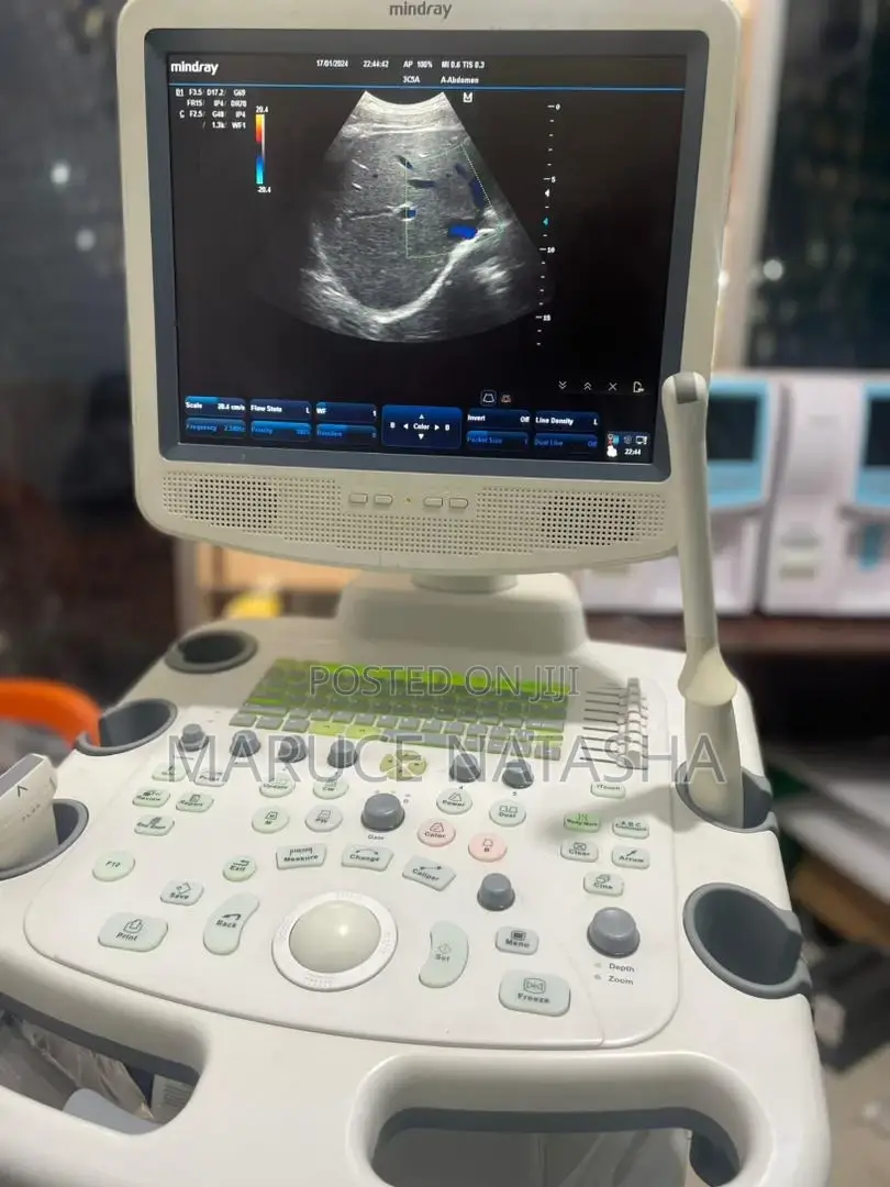 High End 4D Ultrasound Scan With 3probes en a Color Doppler