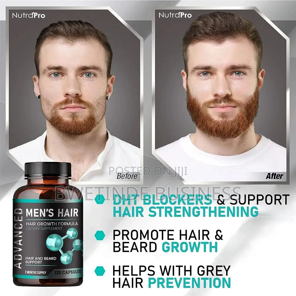 Hair,Beard Growth Supplement Gray Hair Treatment.120 Caps