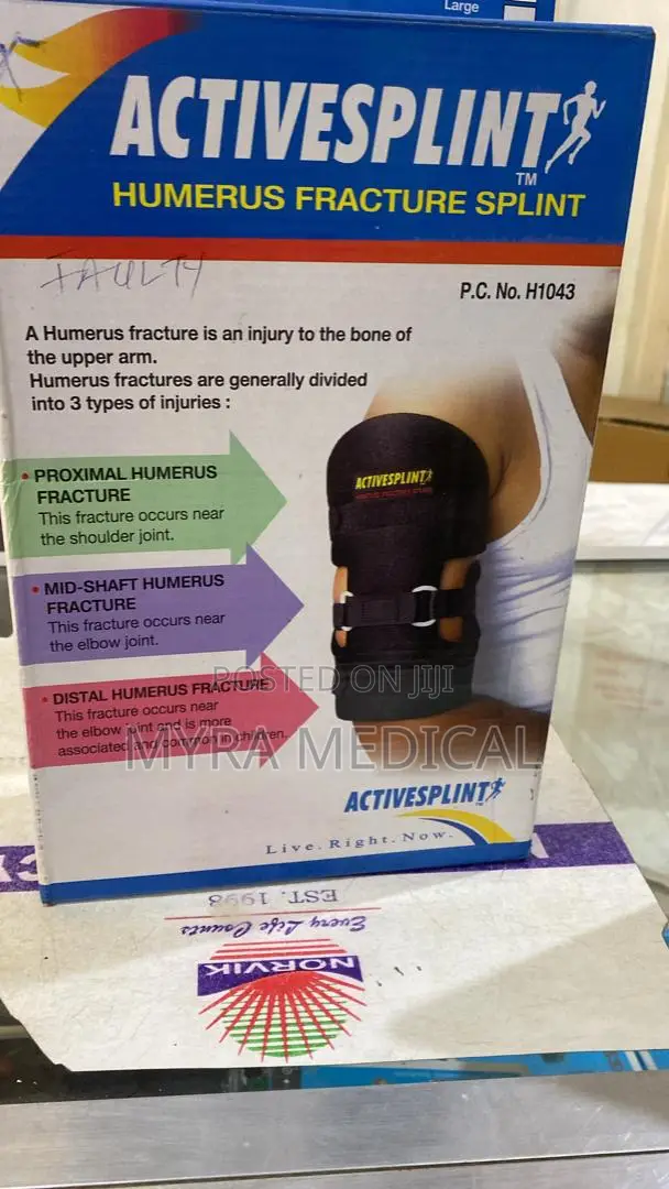 Humerus Fracture Splint