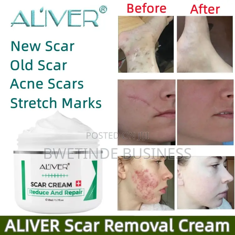 Scar Removal 50g