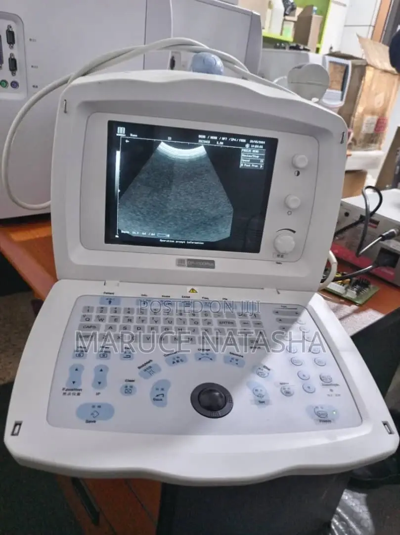 Refurbished Dp 1100 Ultrasound Scan Machine