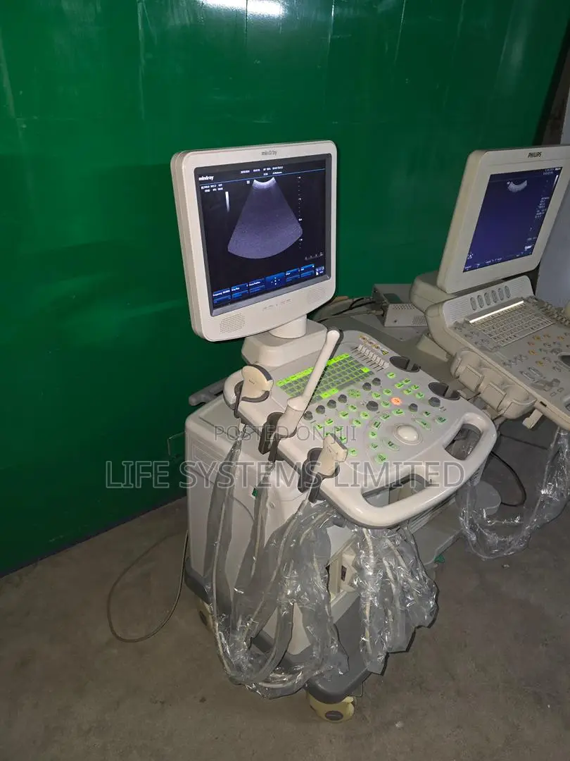 Ultrasound Scans Color Doppler