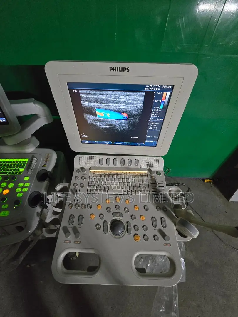 Ultrasound Scans Color Doppler