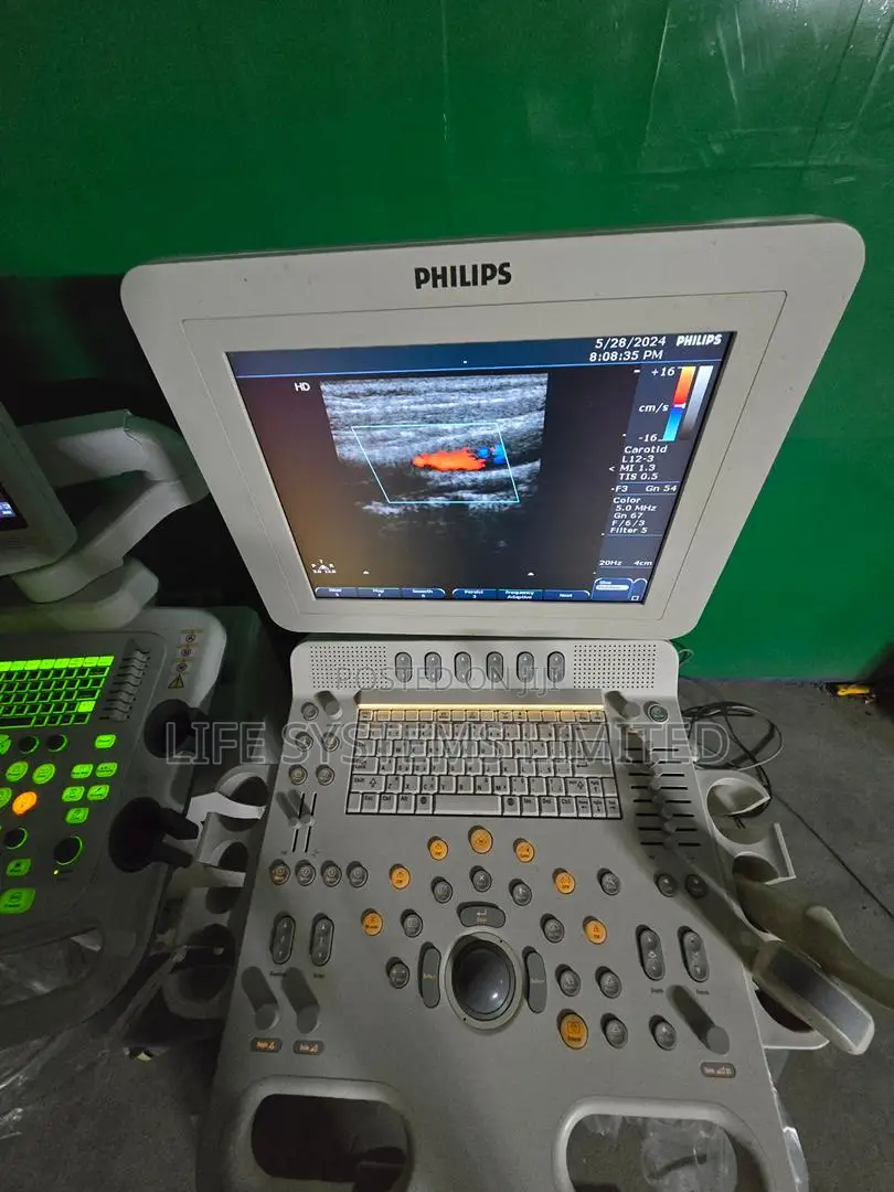Ultrasound Scans Color Doppler