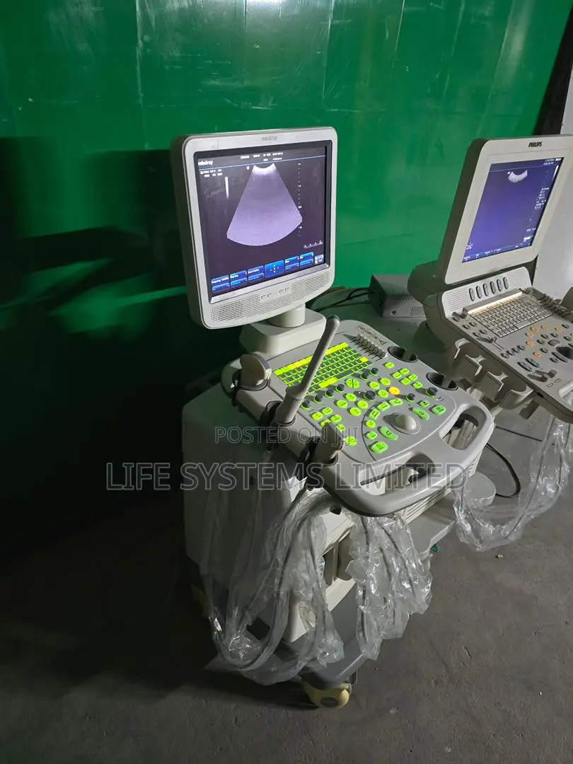 Ultrasound Scans Color Doppler