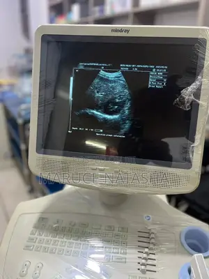 Mindray Dp 7700 Ultrasound Scan