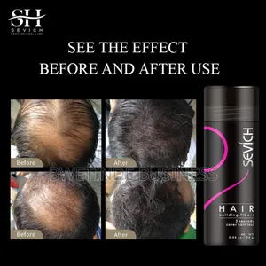Sevich Hair Building Fibres Hair Loss Building Fibres