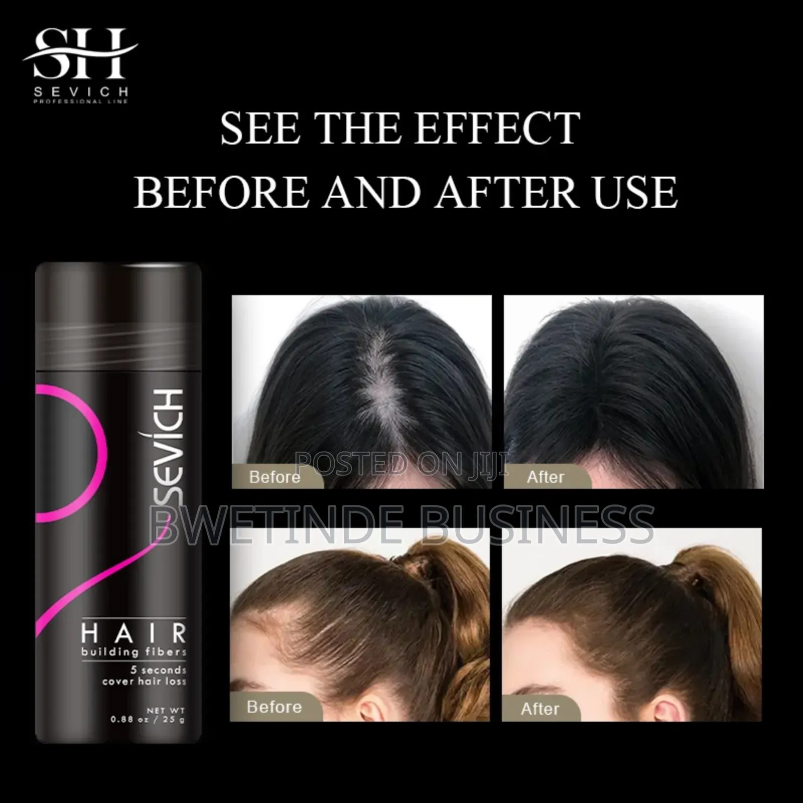 Sevich Hair Building Fibres Hair Loss Building Fibres