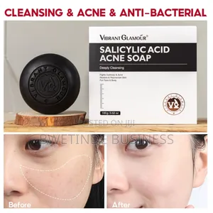 Photo - Salicylic Acid Acne Soap Oil Control