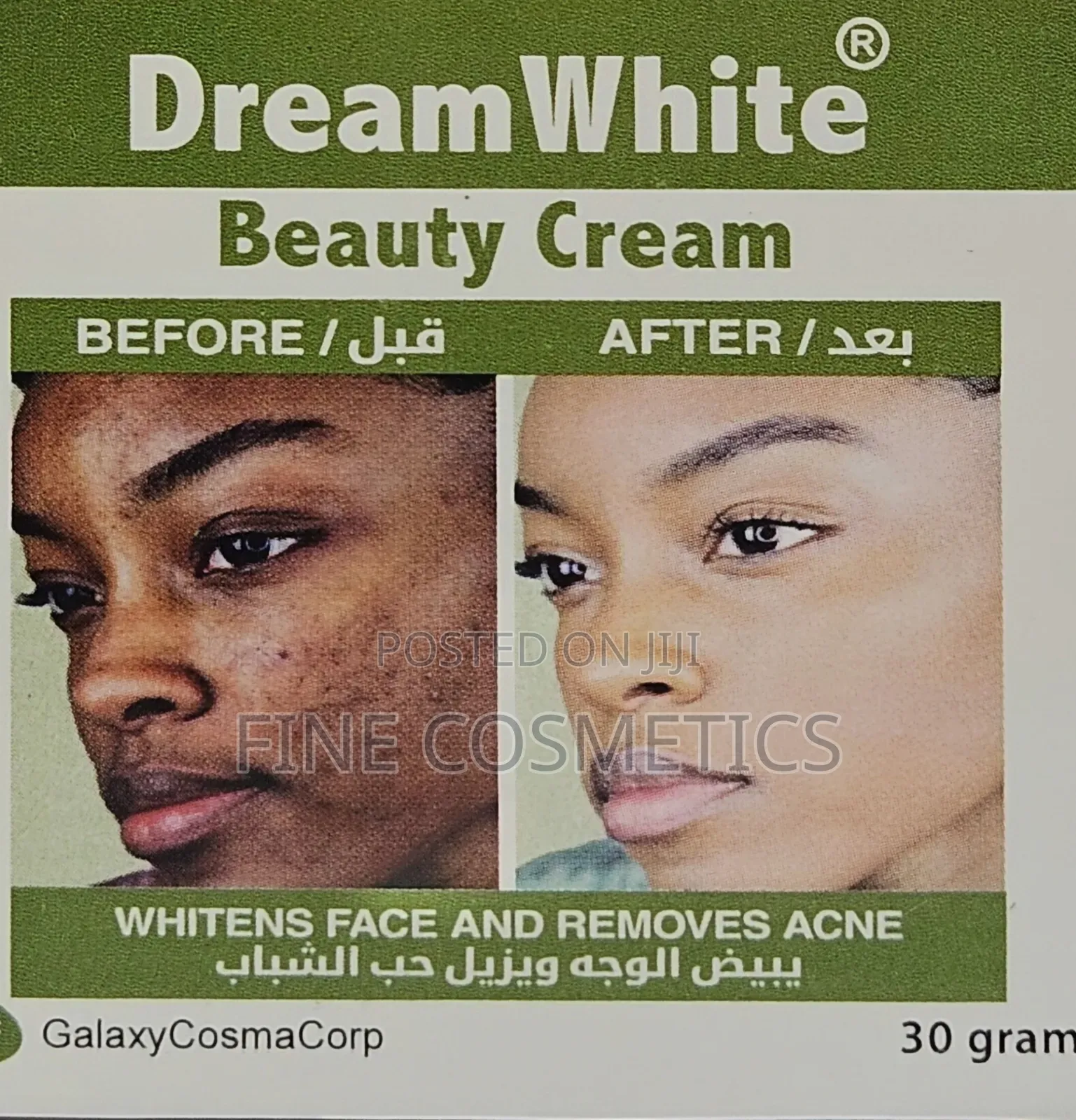 DREAM WHITE BEAUTY CREAM for Pimples, Blackspots, Acne. Etc