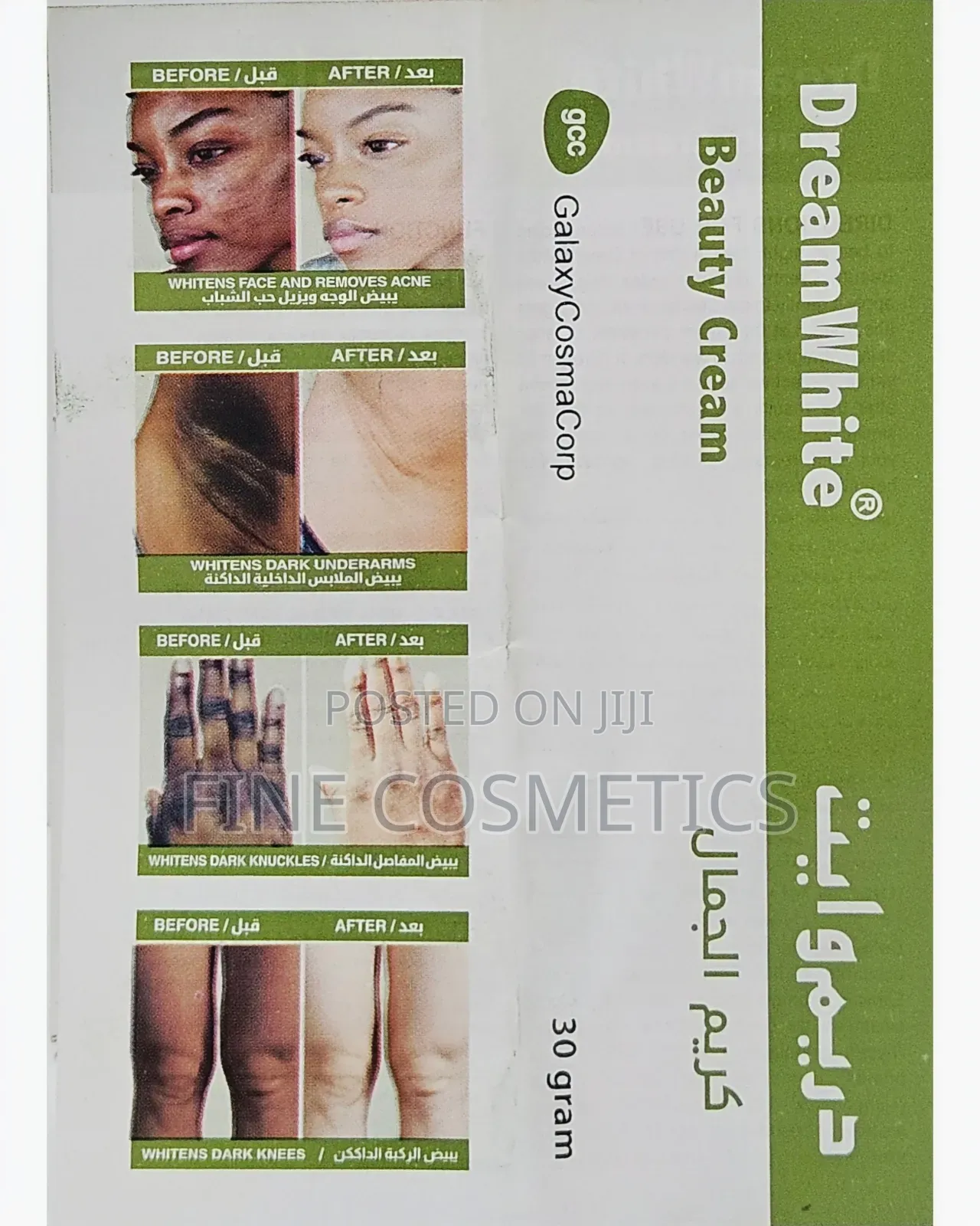 DREAM WHITE BEAUTY CREAM for Pimples, Blackspots, Acne. Etc