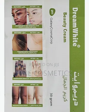 DREAM WHITE BEAUTY CREAM for Pimples, Blackspots, Acne. Etc