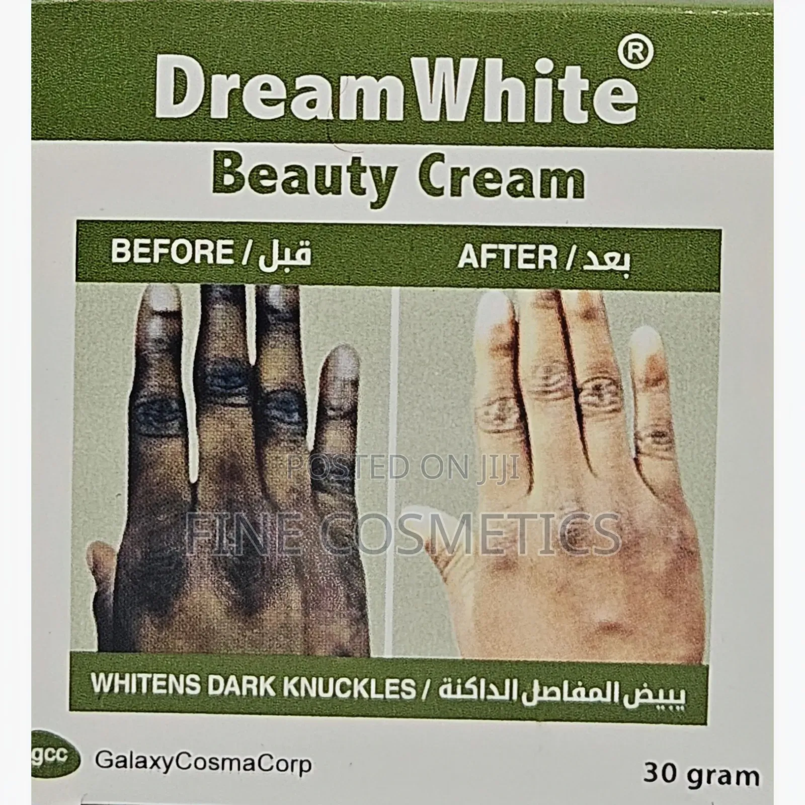 DREAM WHITE BEAUTY CREAM for Pimples, Blackspots, Acne. Etc