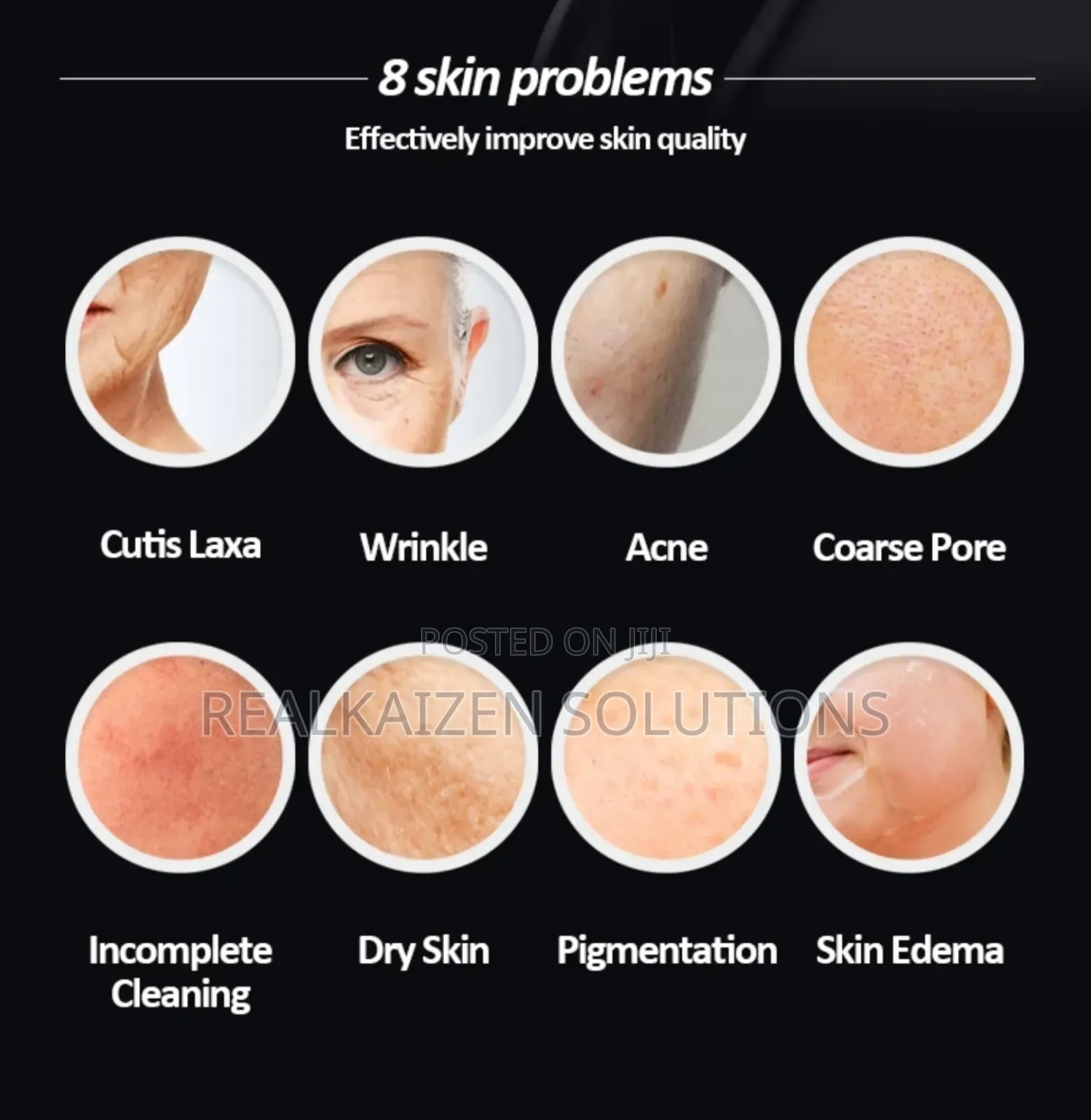 RF Anti-Wrinkle| Firming| Pulse Beauty Instrument Device