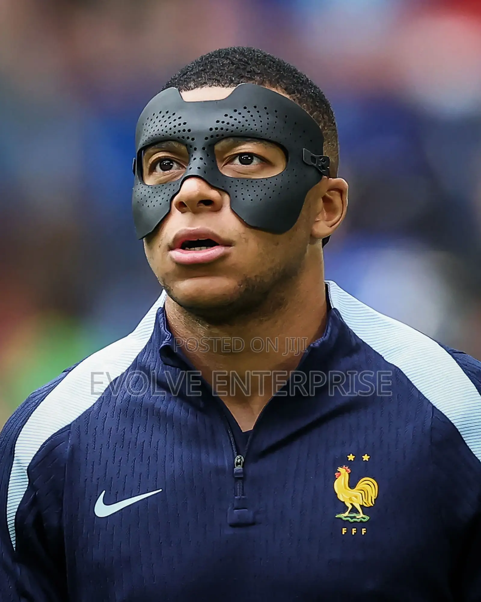 The Mbappe-Osimhen Sports Medicine Face Guard