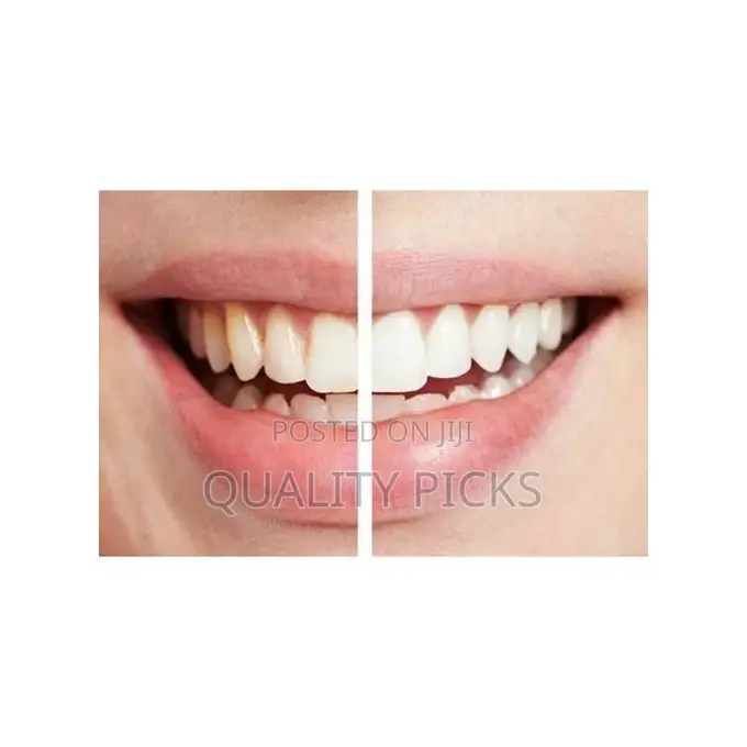 Spark Spin Smile 360 - Professional Tooth Polisher