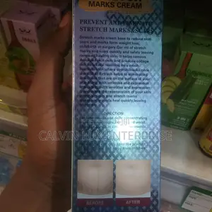 Stretch Marks Remover