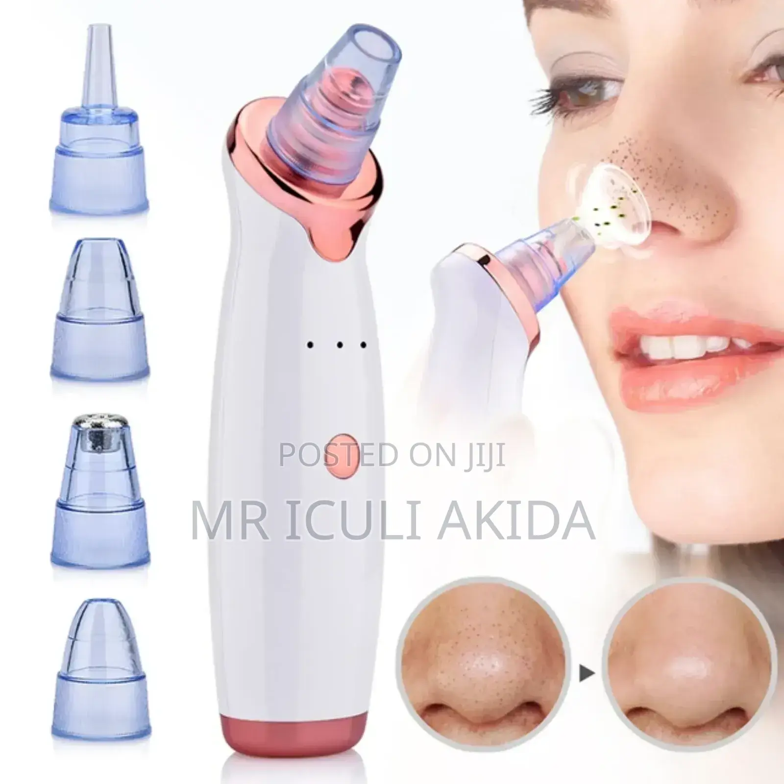 Vacuum Facial Pore Black Head/Pimple Remover With 5heads