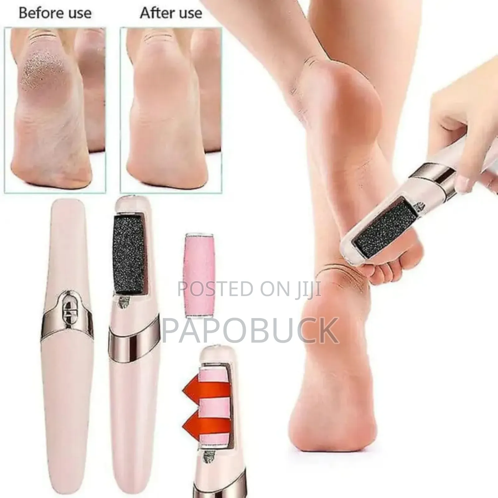 Electric Foot Callus Remover