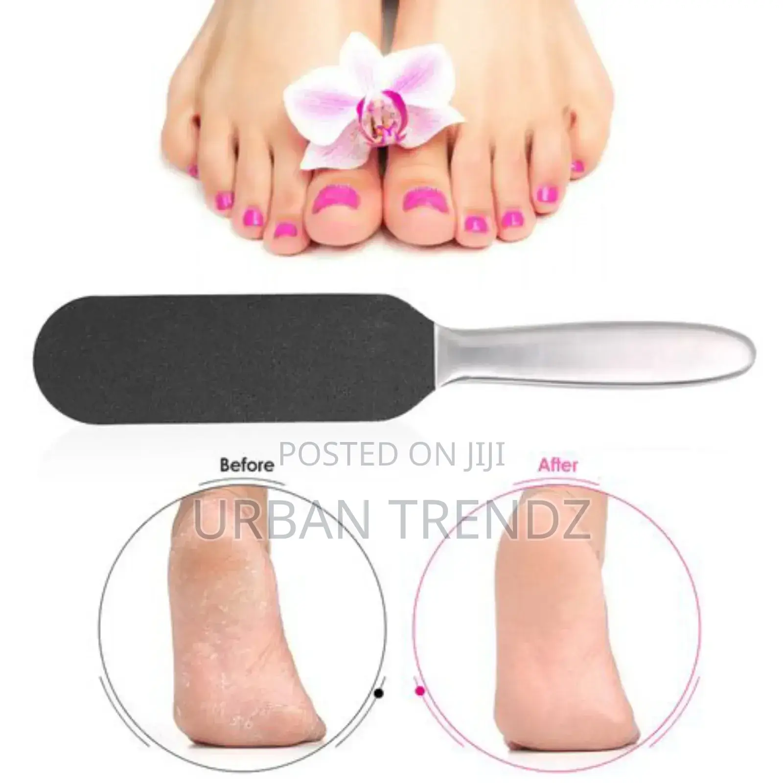Stainless Steel Foot Rasp Kit 1double Side Foot File+10pcs