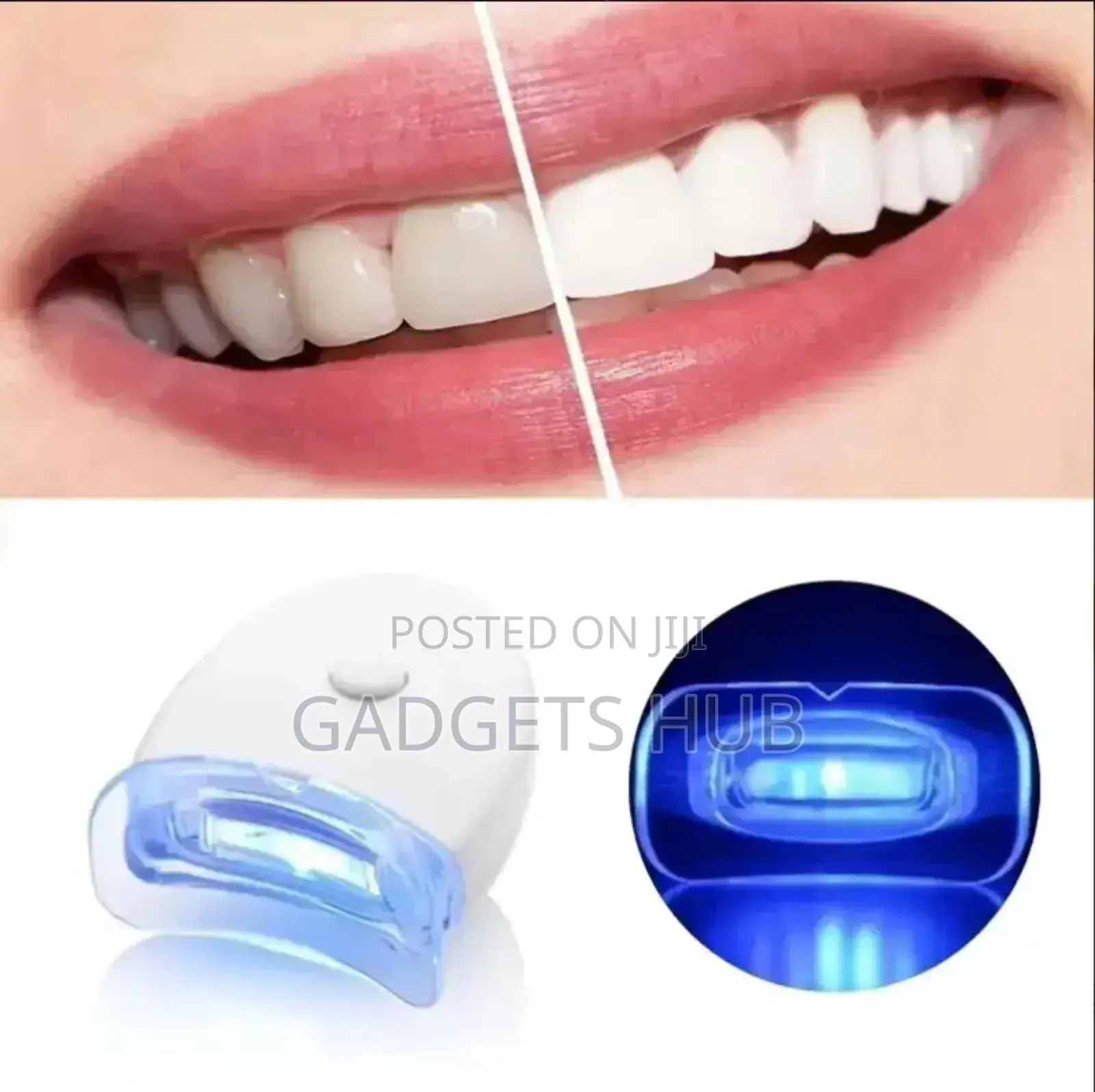 Dental Teeth Whitening Light Bleaching Teeth
Laser Whitener
