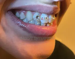 Crystal Teeth Gems
