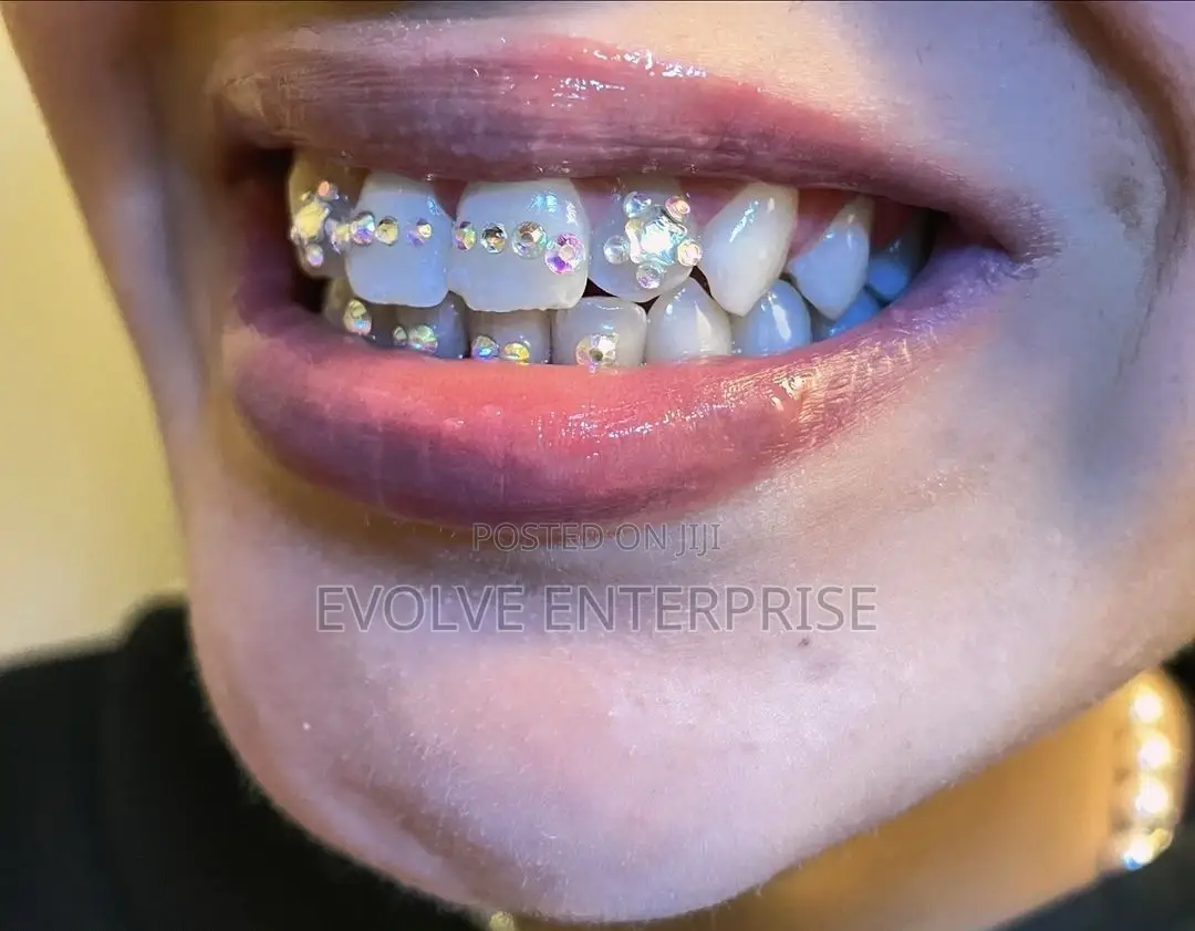 Crystal Teeth Gems