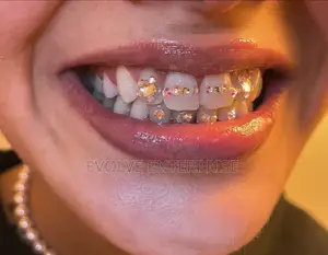 Crystal Teeth Gems