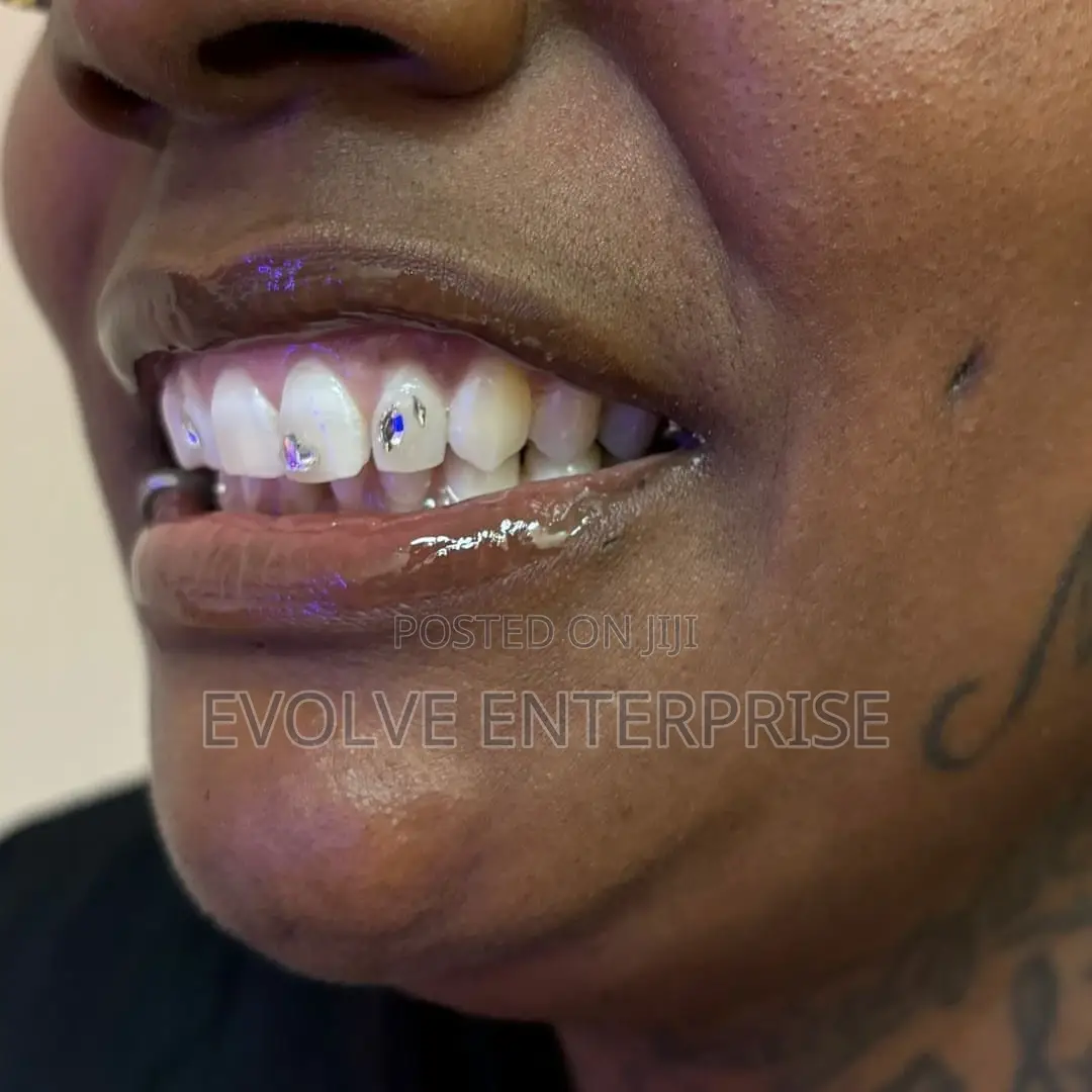 Crystal Teeth Gems