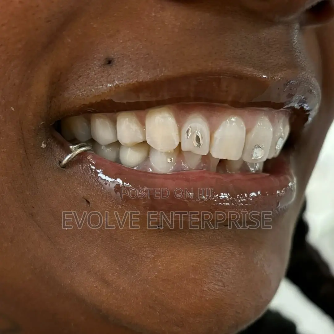 Crystal Teeth Gems