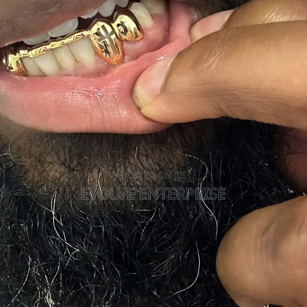 Gold Teeth Grills