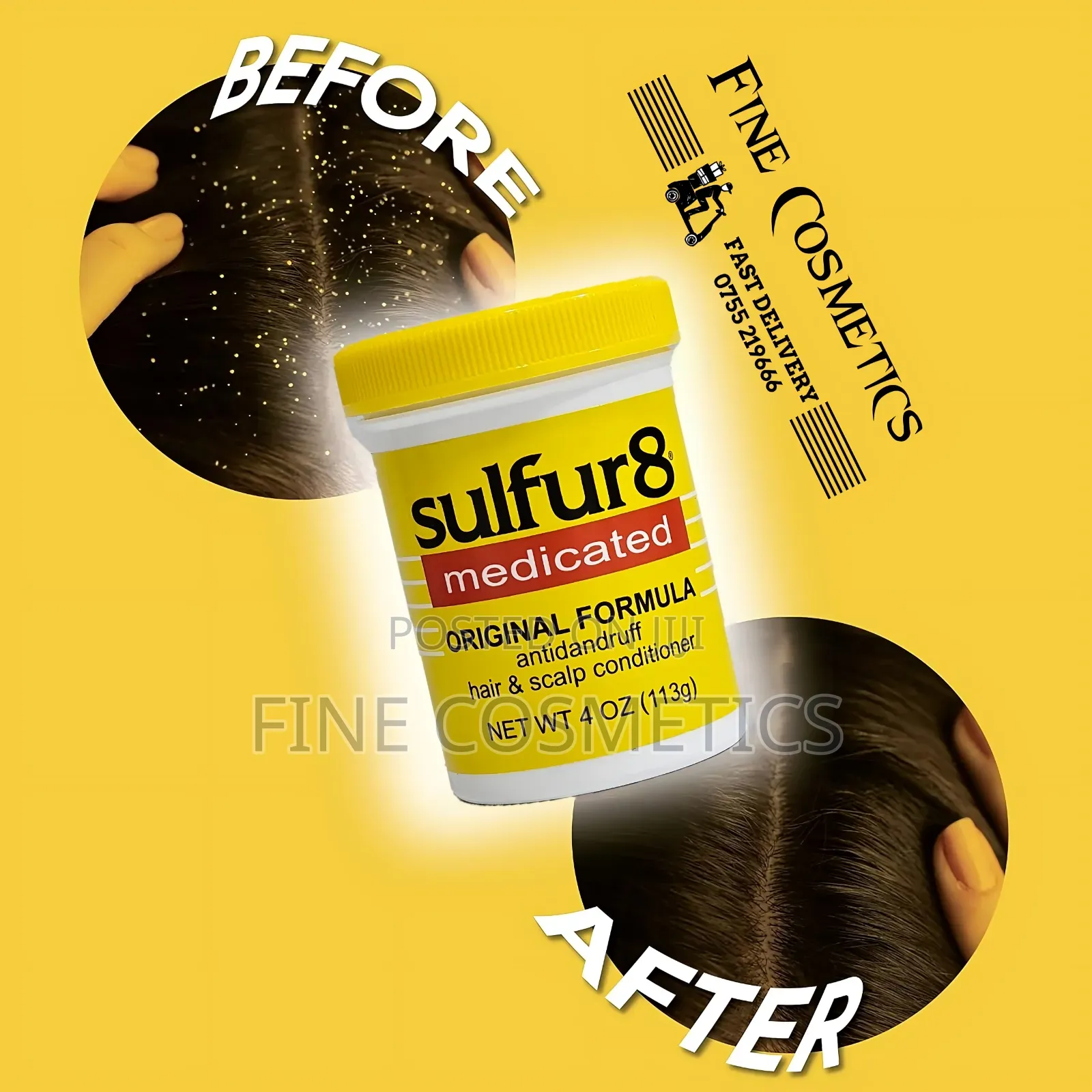 Sulfur8 Medicated Anti-Dandruff Hair + Scalp Anti-Itch Care