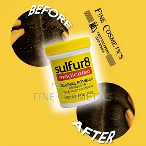 Sulfur8 Medicated Anti-Dandruff Hair + Scalp Anti-Itch Care