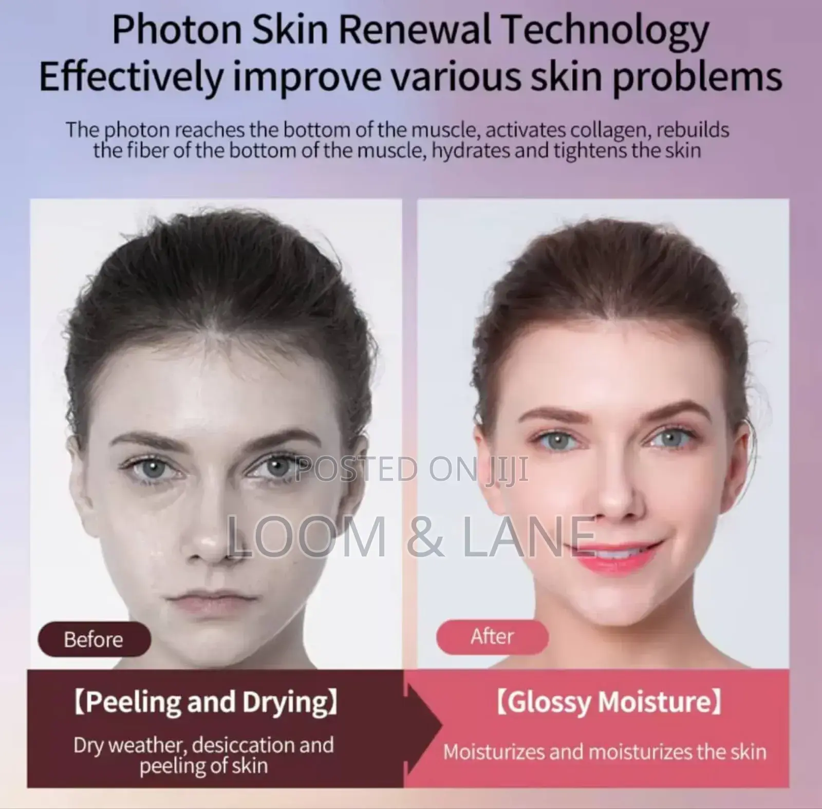 LED Mesotherapy Face Wrinkles Remover and Skin Tightener