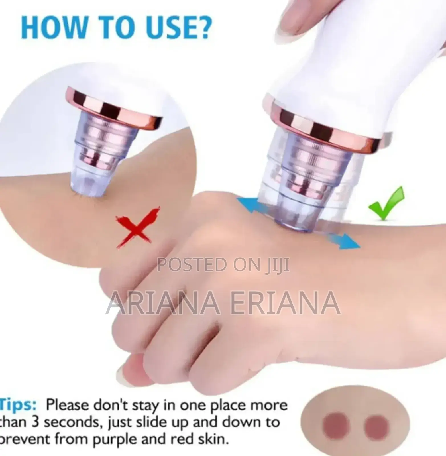 Facial Blackhead Vacuum Pore Cleaner Acne Cleanser