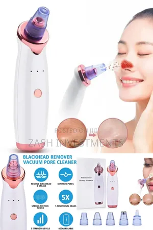 Photo - Facial Blackhead Vacuum Pore Cleaner Acne Cleanser Spots