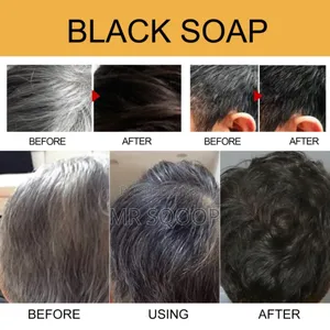 Anti Grey Hair Black Soap Natural Darkening Shampoo