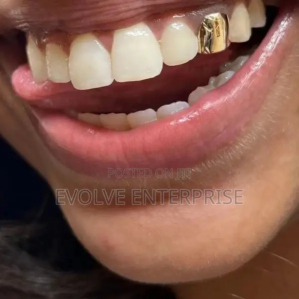 1PC Hip Hop Gold Color Metal Braces Grillz
