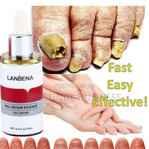 Lanbena Fungal Nail Treatment Repair